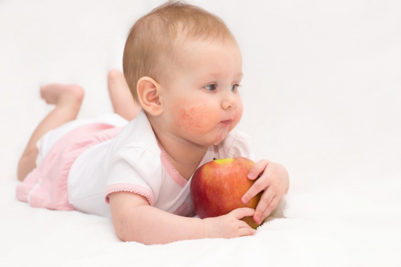 Здоровье ребенка: что такое пищевая аллергия у детей раннего возраста?