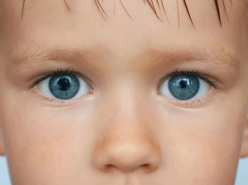 Здоровье глаз: анизокория у ребенка